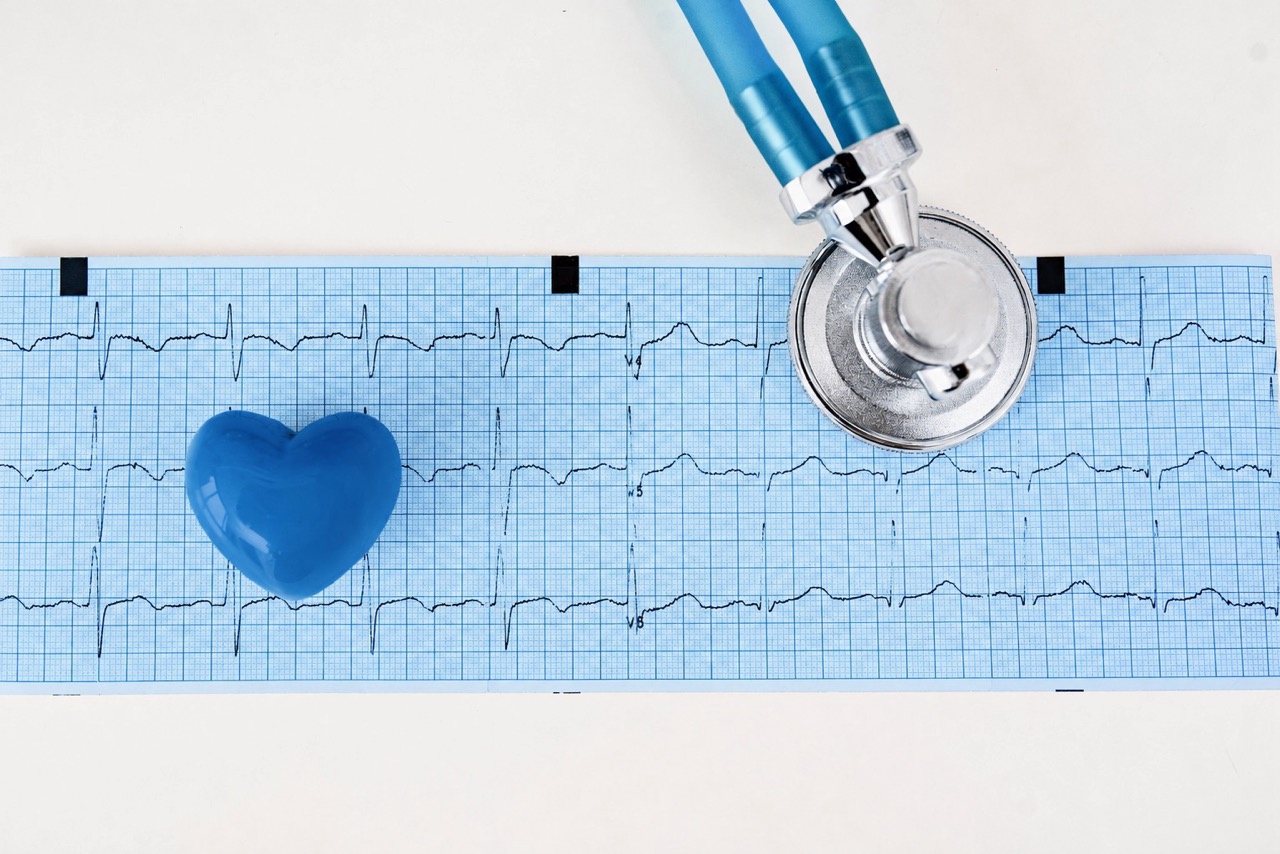 EKG-Streifen mit Stethoskop und einem blauen Herz